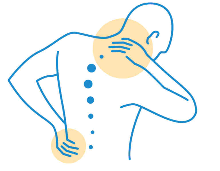 Illustration Schmerzpunkte